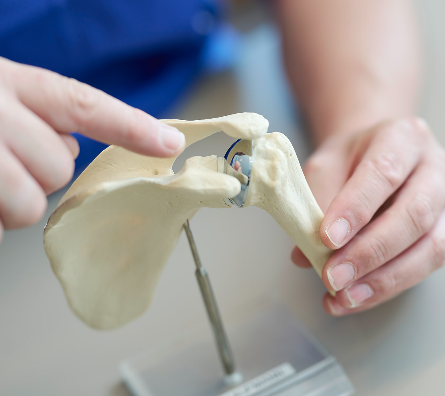 Schultergelenk – Dr. Jörg Kaufmann – Facharzt für Orthopädie und Traumatologie – Dornbirn